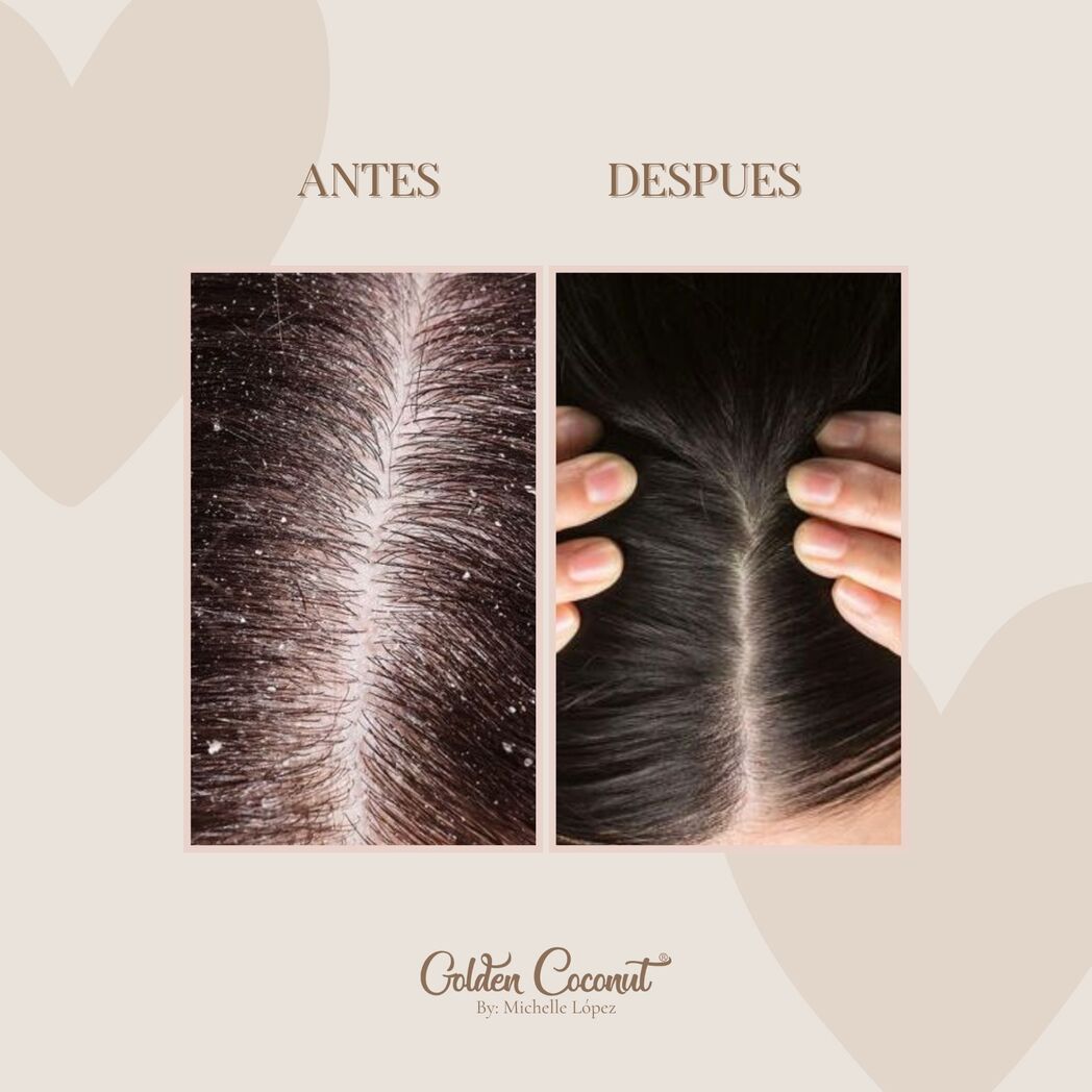 Golden Bloom - Exfoliante Capilar + Masajeador Bundle - Golden Coconut